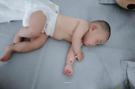百色六个月宝宝眼睛散光